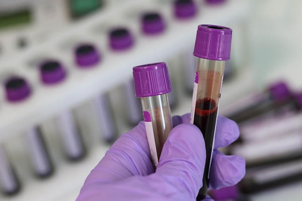 Core Biopsy Needle for Breast tumour 